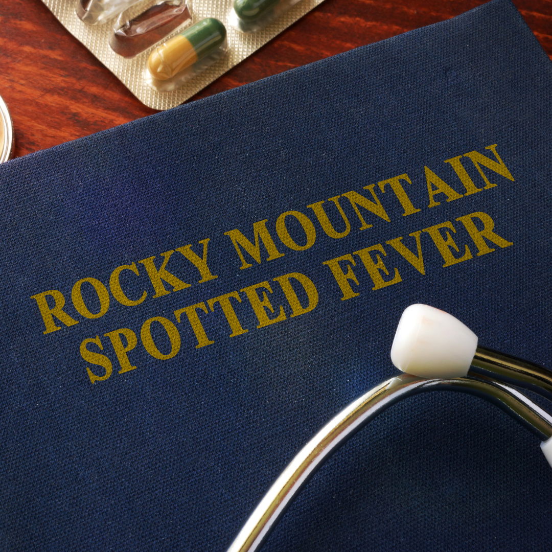 File that says Rocky Mountain Spotted Fever with a stethoscope laying on top